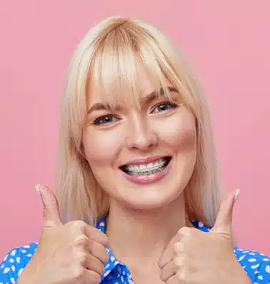 clear-braces-tampa-fl