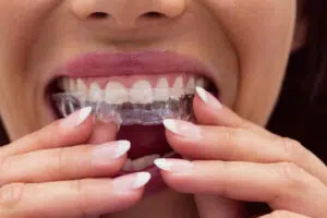 Orthodontist in Tampa FL