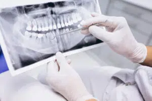 Invisalign in Tampa
