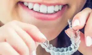 advantages of invisalign