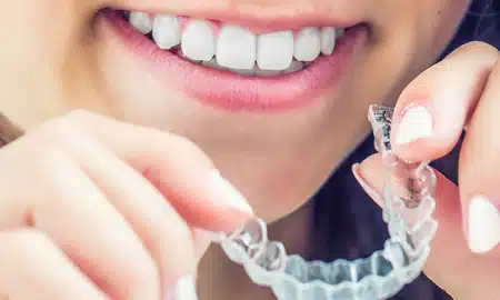 invisalign for teens